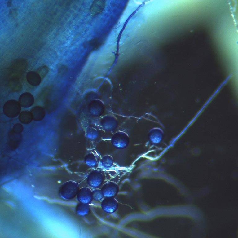 Endomycorrhiza under the microscope